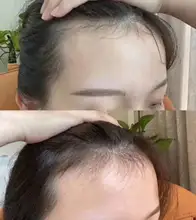 Liquid Spray Hair-Loss-Products Essential-Oil Dry-Hair Omy Lady Regeneration-Repair 