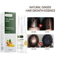 Espray de jengibre para el crecimiento del cabello, aceite de esencia para el cabello de rápido crecimiento, pérdida de cabello productos Anti, previene el adelgazamiento del cabello, reparación del cabello seco y rizado