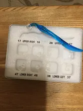 Kit de molde de impresión Dental Posterior, herramientas de llenado de restauración Dental