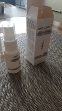 OMY LADY-aceite esencial para hombres y mujeres, Spray para el crecimiento del cabello, líquido para la pérdida de cabello seco, reparador, producto para la pérdida de cabello