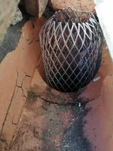 Techo protector de alcantarilla filtros de 3 pulgadas ampliar de aluminio filtro deja de bloqueo de drenajes de desechos de drenaje neto cubierta