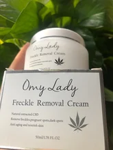 Freckle-Removal-Cream Whitening Remove-Freckle Melanin Dark-Spot Anti-Aging Omy Lady