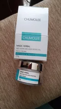 CHUMOLEE-Crema de blanqueamiento potente Facial, crema Facial para eliminar manchas de melanina, pecas, Melasma, acné, pigmento oscuro, crema de espinillas