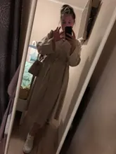 Summer Dresses Buttons V-Neck Lace-Up Oversize Colorfaith Women Spring Vintage Casual