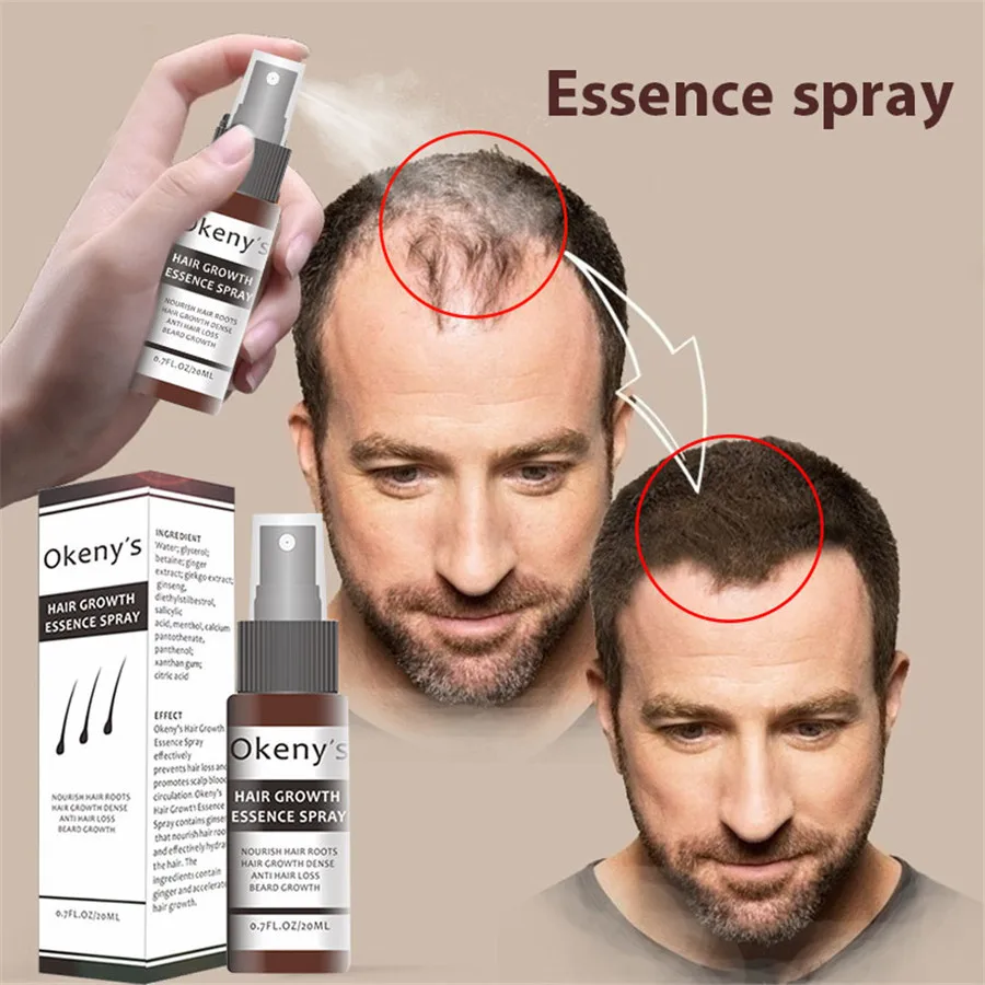 От выпадения волос спрей для роста волос эфирное масло жидкость для мужчин и женщин сухая регенерация волос ремонт волос выпадения продукты