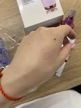 Aparato para limpieza profunda de la piel con espinillas, limpiador con punta de diamante de Zona T para nariz y resto del rostro, para la eliminación de espinillas, succión al vacío