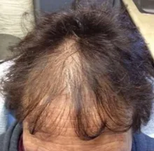 Champú y acondicionador para el crecimiento del cabello con queratina brasileña, conjunto para mejorar el crecimiento del cabello, regalos, previene el cuidado de las mujeres de 200ml