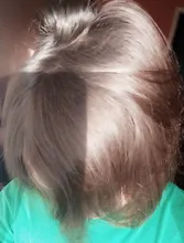 Esencia rápida y potente para el crecimiento del cabello, productos para la pérdida del cabello, tratamiento líquido de aceite esencial, productos para el cuidado del cabello, 20ml