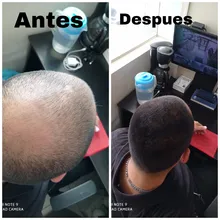 Extensión de polvo de fibras para el cabello, polvos de queratina para el crecimiento del cabello, para la construcción del cabello