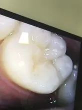 Cámara Dental inalámbrica con WiFi, endoscopio Intraoral ajustable, 1080p, HD, 8 luces LED, Cable USB, herramienta de inspección bucal para dentista