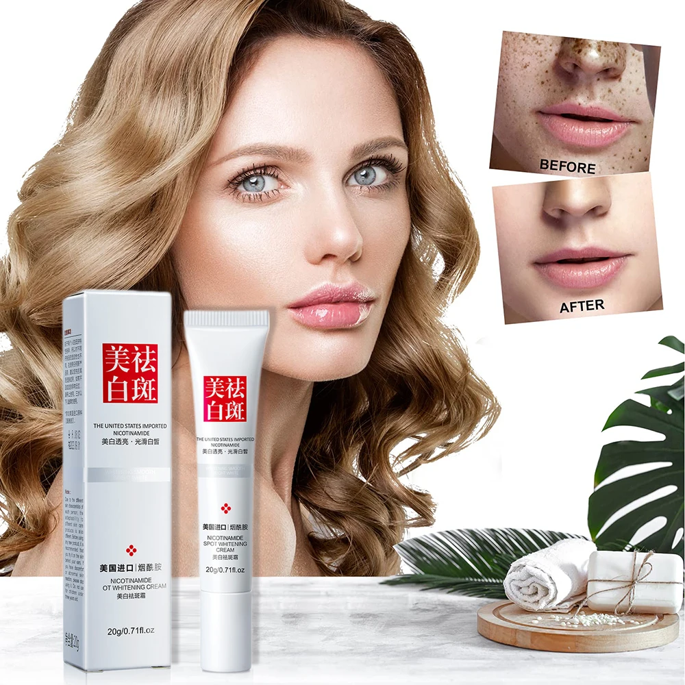 Whitening Freckle Cream Remove Melasma Acne Spot Pigment Melanin Dark Spots Pigmentation Freckle Removal Cream Moisturizing Gel