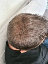 Aplicador de queratina para la pérdida del cabello, polvos de fibra de construcción para el crecimiento del cabello, Spray de estilismo, extensión de polvo de Color para adelgazamiento