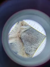 Lupa con mango de dermatoscopio 10X, visión clara suave con escala de medida, 30X, tipo B, visión más grande con luz UV