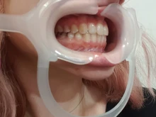 Oral oral ortodoncia tipo C, Retractor de labios y mejillas con mango de alta calidad, transparente, 1 Uds.