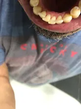 Eliminador de cálculo ultrasónico para el hogar, escarificador Dental eléctrico portátil, manchas de humo sónicas, placa de sarro, dientes blancos