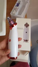 Eliminador de espinillas faciales eléctrico para acné, aspiradora de puntos negros, herramienta de limpieza de poros negros