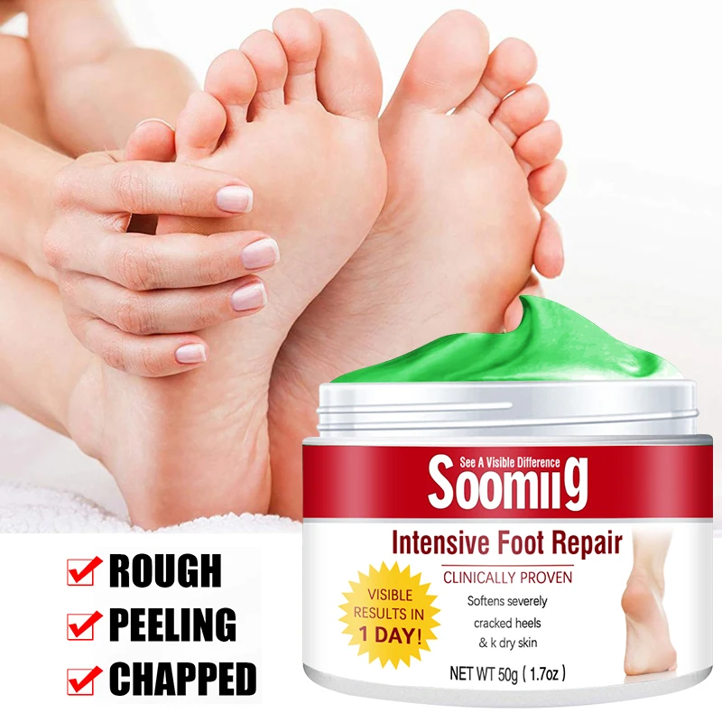 SOOMIIG 50g Oil Anti Drying Crack Foot 