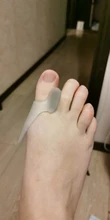 Separador de dedos para juanete de silicona, ajuste de ectropión, Corrector de Hallux Valgus, aparato exterior para el cuidado de los pies, 6 uds.