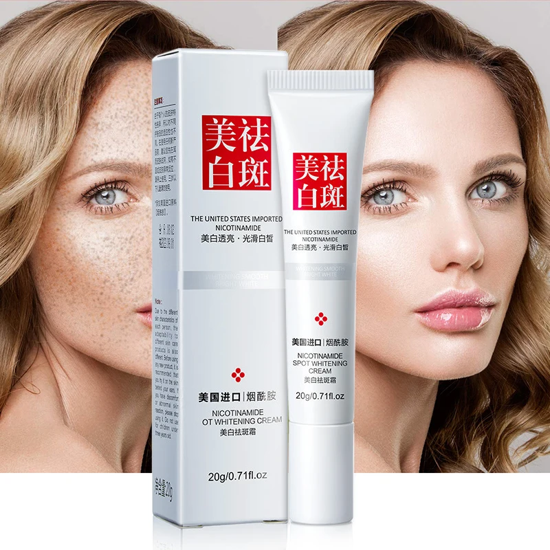 Whitening Freckle Cream Remove Melasma Acne Spot Pigment Melanin Dark Spots Pigmentation Freckle Removal Cream Moisturizing Gel