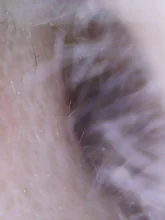 Endoscopio de limpieza de orejas, herramienta boroscopio para el cuidado de la salud, endoscopio, USB, Visual, 5,5mm, cámara de 0.3MP, Android, PC