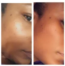 9 engranajes bolígrafo de Plasma láser Etiqueta de piel de Topo removedor de pecas verruga tatuaje mancha removedor multifunción LCD herramienta de belleza