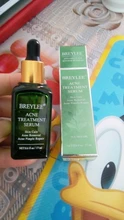 BREYLEE-suero para el tratamiento del acné Facial, producto para el cuidado de la piel, eliminación de cicatrices, granos, blanqueamiento y acné
