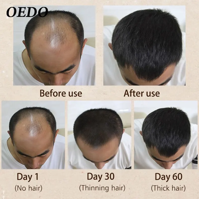 

100% Hair Remover and Bleach Remover Organic Soap Free Shipping