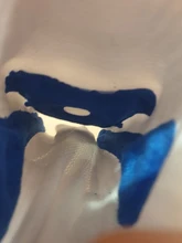 Veidoorn-rodilleras para hombre y mujer, rodilleras deportivas, soporte de rodilla, rótula de Fitness, carrera baloncesto fútbol, tenis, 1 Uds.