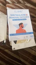 Parche para la piel con eliminador de marcas en la piel, parche para espinillas, hidrocoloide parche, protección de la piel, novedad de 144 Uds.