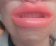 Herramienta de silicona adelgazante facial, herramientas de masaje muscular de boca Oral, ejercitador, entrenador para labios, antiarrugas, cuidado facial