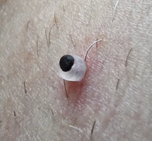 30 unids/caja de bandas de goma de la piel de alta calidad Etiqueta de eliminación de bandas de goma Micro banda no tóxico cuidado topo verruga cuidado de la piel