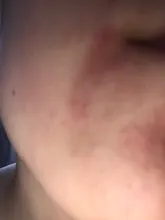 Eliminador de espinillas por dermoabrasión y succión al vacío, limpiador de poros faciales, eliminación de espinillas, microdermoabrasión, succión al vacío de granos, acné y puntos negros, cuidado de la piel