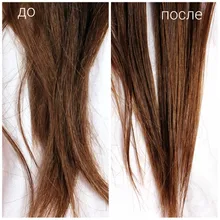 Esencia rápida y potente para el crecimiento del cabello, productos para la pérdida del cabello, tratamiento líquido de aceite esencial, productos para el cuidado del cabello, 20ml
