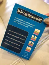 Kit de eliminación de verrugas y microbanda para la piel, eliminador de verrugas con hisopo de limpieza, topos y verrugas para adultos, cuidado facial