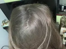 HAIRCUBE-esencia para el crecimiento del cabello, tratamiento para la pérdida del cabello, anticaída, prevención, Alopecia, líquido dañado, reparación del cabello