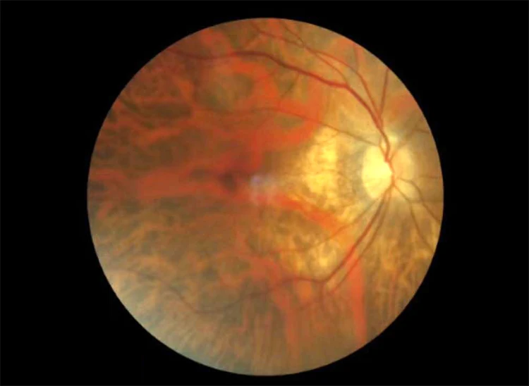 Портативная немидрическая сетчатая камера с камерой FDA для США|cameras camera|camera