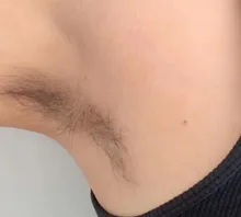 Máquina portátil de depilación, diodo láser de 808nm, Para rejuvenecimiento de la piel, máquina de depilación de 808nm, Envío Gratis