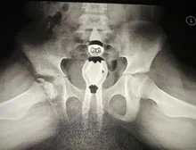 Power-Supply-Adapter Universal Adjustable Volt 24v 1a 12-V 220V 5V 9V DC 5A 6V AC To