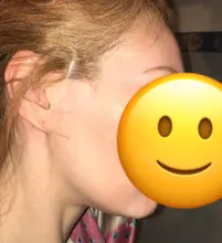 40 unids/set adhesivos faciales para rostro fino e invisible línea de arrugas flácida piel en forma de V cinta de elevación Facial Scotch para cara