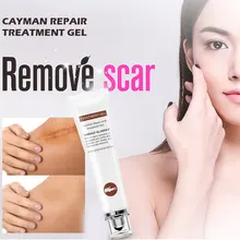 Яркий гламурный крем мазь для лечения шрамов гель крем от прыщей акне крем для лица Уход за телом лечение кожи автомобиля осветление уход