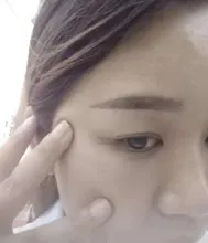 Crema blanqueadora para pecas, crema facial de hierbas chinas, elimina pecas y manchas oscuras, 30g