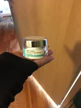 CHUMOLEE-Crema de blanqueamiento potente Facial, crema Facial para eliminar manchas de melanina, pecas, Melasma, acné, pigmento oscuro, crema de espinillas