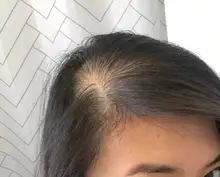 HAIRCUBE-esencia para el crecimiento del cabello para hombres y mujeres, suero para el crecimiento del cabello, Germinal rápido, cuidado del cabello, reparación, líquido antipérdida de cabello más grueso