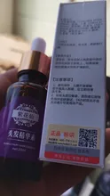 Esencia para el cuidado del cabello, cuidado del cabello Natural, sin efectos laterales, prevención de pérdida de cabello, crecimiento rápido efectivo, nutre, Control de aceite, reparación