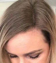 PURC-productos para el crecimiento del cabello para hombres y mujeres, aceite de crecimiento rápido, cuidado para la pérdida del cabello, tratamiento para el cuero cabelludo y el cabello, 30ml