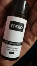 EFERO-esencia para el crecimiento del cabello, aceite esencial para la pérdida de cabello denso, crecimiento rápido del cabello, restauración