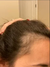 HAIRCUBE-esencia para el crecimiento del cabello, tratamiento para la pérdida del cabello, anticaída, prevención, Alopecia, líquido dañado, reparación del cabello