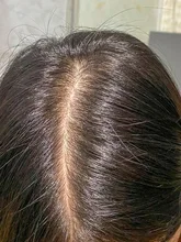 PURC-productos para el crecimiento del cabello para hombres y mujeres, aceite de crecimiento rápido, cuidado para la pérdida del cabello, tratamiento para el cuero cabelludo y el cabello, 30ml