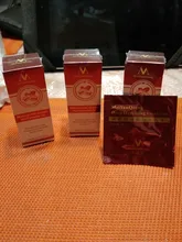 Esencia rápida y potente para el crecimiento del cabello, productos para la pérdida del cabello, tratamiento líquido de aceite esencial, productos para el cuidado del cabello, 20ml