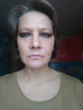 Masajeador Facial EMS con luz LED, terapia de vibración Sónica, eliminación de arrugas, estiramiento de la piel, tratamiento frío caliente, dispositivo de belleza para el cuidado de la piel